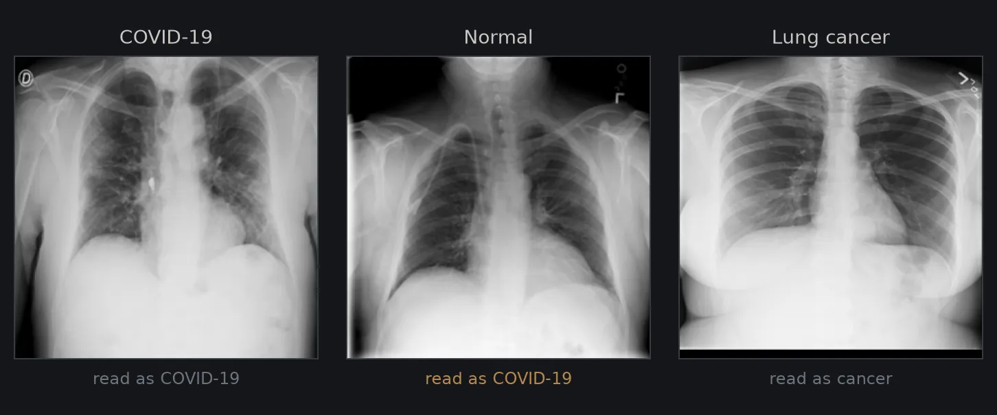 Three chest X-rays: a COVID-19 scan read as COVID-19, a normal scan read as COVID-19, and a lung cancer scan read as cancer